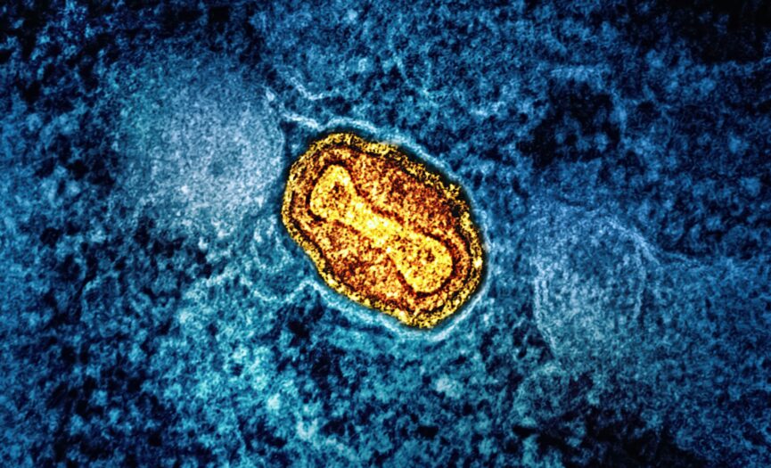 Mitochondria in yellow inside a cell.
